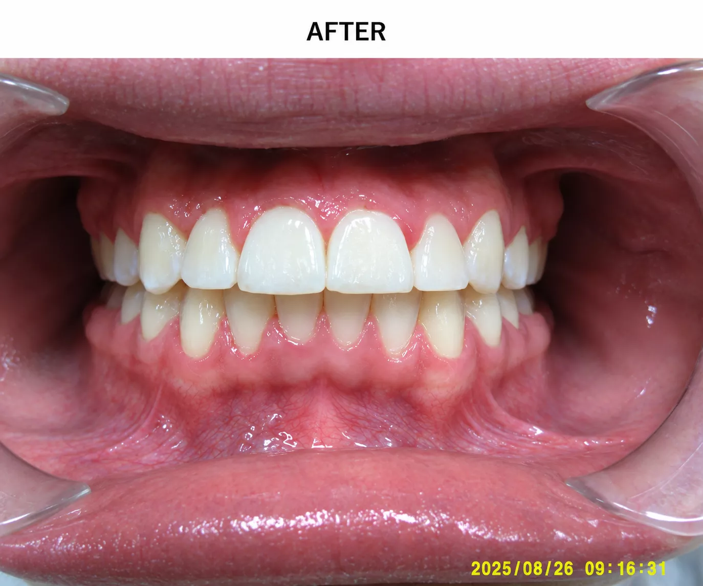 5-after-6ab45ae1413b3