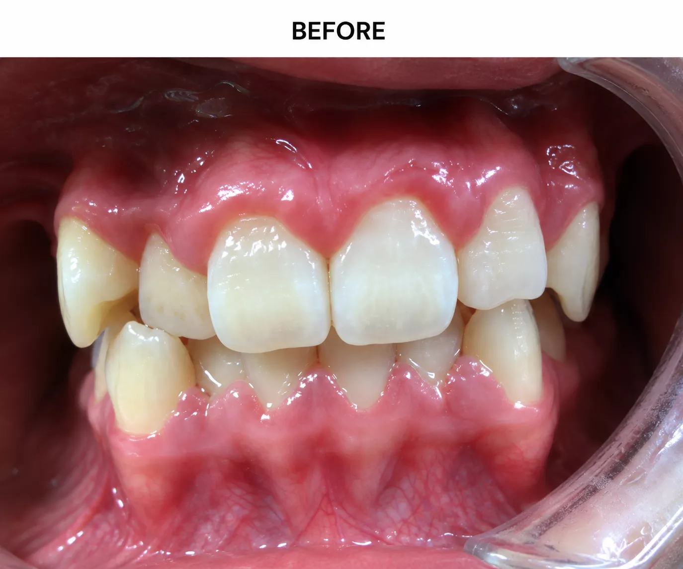 6before-6ab45ae2650de
